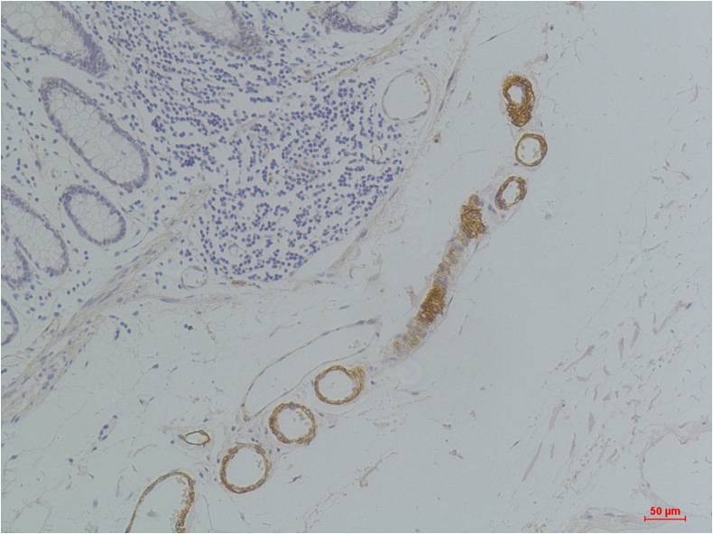 GRIK2(GluR6) Rabbit pAb