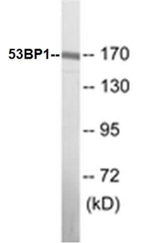 Western blot analysis of extracts from A549 cells, using 53BP1 (Ab-6) Antibody.