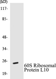 Western blot analysis of the lysates from HUVECcells using RPL10L antibody.