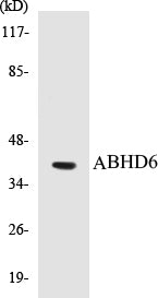 Western blot analysis of extracts from COLO cells, using ABHD6 Antibody.