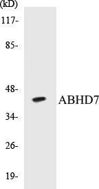 Western blot analysis of the lysates from HeLa cells using ABHD7 antibody.