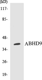 Western blot analysis of extracts from MCF-7 cells, using ABHD9 Antibody.