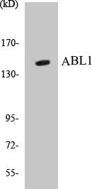 Western blot analysis of extracts from COS7 cells, treated with calyculinA 50ng/ml 30', using ABL1 (Ab-735) Antibody.