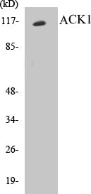 Western blot analysis of the lysates from COLO205 cells using ACK1 antibody.