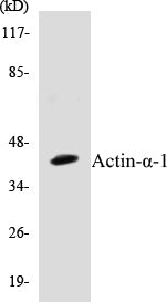 Western blot analysis of extracts from rat muscle cells, using Actin-alpha-1 Antibody.
