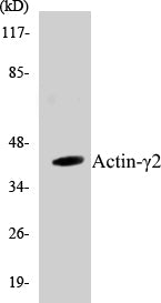 Western blot analysis of extracts from COLO205 cells, using Actin-gamma2 Antibody.