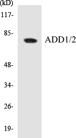 Western blot analysis of extracts from HeLa cells, treated with Forskolin 40nM 30', using ADD1 (Ab-726) Antibody.