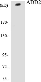 Western blot analysis of the lysates from HeLa cells using ADD2 antibody.