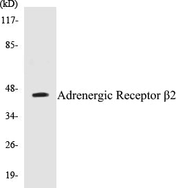 Western blot analysis of extracts from NIH-3T3 cells, using Adrenergic Receptor beta2 (Ab-346) Antibody.