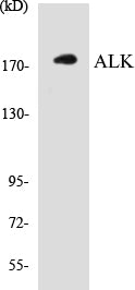 Western blot analysis of extracts from LOVO cells, using ALK (Ab-1507) Antibody.