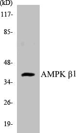 Western blot analysis of extracts from HepG2/Jurkat/HuvEc/MCF-7 cells, using AMPK beta1 (Ab-181) Antibody.