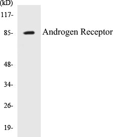 Western blot analysis of extracts from K562 cells, treated with EGF 200ng/ml 5', using Androgen Receptor (Ab-363) Antibody.