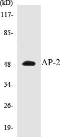 Western blot analysis of extracts from COLO205 cells, using AP-2 Antibody.