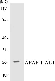 Western blot analysis of extracts from COLO205 cells, using APAF-1-ALT Antibody.