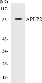 Western blot analysis of extracts from rat brain, using APLP2 (Ab-755) Antibody.