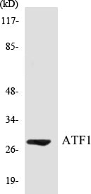 Western blot analysis of extracts from COLO cells, using ATF1 (Ab-63) Antibody.