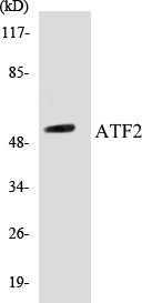 Western blot analysis of extracts from MDA-MB-435 cells, using ATF2 (Ab-112 or 94) Antibody.