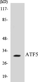 Western blot analysis of extracts from Jurkat cells, using ATF5 Antibody.