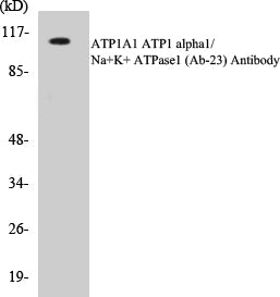 Western blot analyzes of Na+/K+-ATPase α1 antibody in extracts from A549 cells.