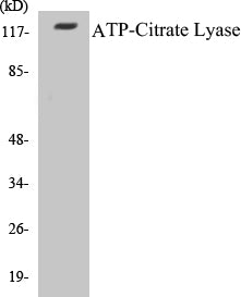 Western blot analysis of extracts from COS7 cells, treated with Calyculin 50nM 30', using ATP-Citrate Lyase (Ab-454) Antibody.