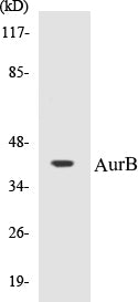 Western blot analysis of extracts from COS7 cells, treated with Nocodazole 1ug/ml 16h, using AurB (Ab-232) Antibody.