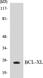 Western blot analysis of extracts from 293 cells, treated with UV, using BCL-XL (Ab-62) Antibody.