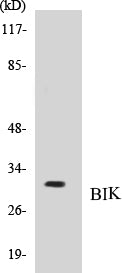 Western blot analysis of extracts from HuvEc/COLO205, using BIK (Ab-33) Antibody.