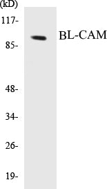 Western blot analysis of extracts from 293 cells, treated with Ca2+ 40nM 30', using BL-CAM (Ab-807) Antibody.