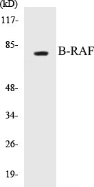 Western blot analysis of extracts from rat brain, using B-Raf (Ab-753) Antibody.