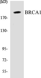 Western blot analysis of extracts from 293 cells treated with epo 20U/ml 15', using BRCA1 (Ab-1457) Antibody.