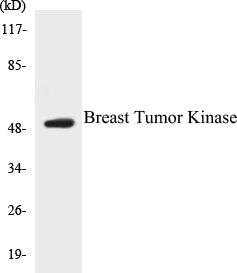 Western blot analysis of extracts from LOVO cells, using Breast Tumor Kinase Antibody.
