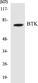 Western blot analysis of extracts from HeLa cells, using BTK (Ab-222) Antibody.