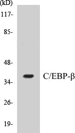 Western blot analysis of extracts from NIH-3T3 cells, using C/EBP-beta (Ab-235/188) Antibody.