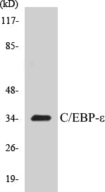 Western blot analysis of extracts from JurKat cells, treated with Insulin 0.01U/ml 15', using C/EBP-epsilon (Ab-74) Antibody.