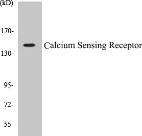 Western blot analysis of extracts from LOVO cells, using Calcium Sensing Receptor (Ab-888) Antibody.