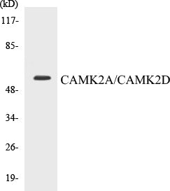 Western blot analysis of extracts from NIH-3T3/K562 cells, using CaMK2 alpha/delta (Ab-286) Antibody.