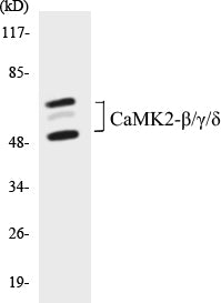 Western blot analysis of extracts from rat brain cells, using CaMK2-beta/gamma/delta (Ab-287) Antibody.