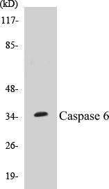 Western blot analysis of extracts from HepG2/RAW264.7 cells, using Caspase 6 (Ab-257) Antibody.