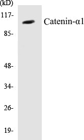 Western blot analysis of extracts from HeLa cells, using Catenin-alpha1 Antibody.