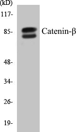 Western blot analysis of extracts from COS7/HT-29 cells, using Catenin-beta (Ab-33) Antibody.