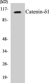 Western blot analysis of extracts from HuvEc cells, using Catenin-delta1 (Ab-228) Antibody.