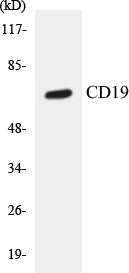 Western blot analysis of extracts from COS7 cells, treated with Serum 10% 30', using CD19 (Ab-531) Antibody.
