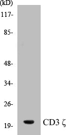 Western blot analysis of extracts from Jurkat cells, treated with UV 15', using CD3 zeta (Ab-42) Antibody.