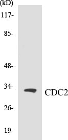 Western blot analysis of extracts from HepG2 cells, using CDC2 (Ab-161) Antibody.