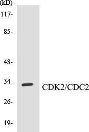Western blot analysis of extracts from A2780 cells, using CDK2 (Ab-160) Antibody.