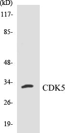 Western blot analysis of extracts from HepG2/Jurkat cells, using CDK5 (Ab-15) Antibody.