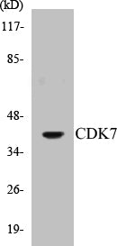 Western blot analysis of extracts from Raw264.7 cells, treated with Calyculin A 50ng/ml 30', using CDK7 (Ab-170) Antibody.