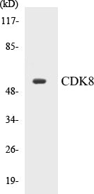 Western blot analysis of extracts from 293 cells, using CDK8 Antibody.