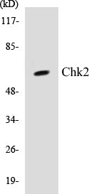 Western blot analysis of extracts from 293 cells treated with UV, using Chk2 (Ab-516) Antibody.