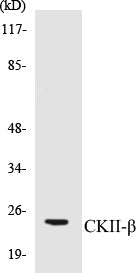 Western blot analysis of extracts from HuvEc cells, using CKII-beta (Ab-209) Antibody.